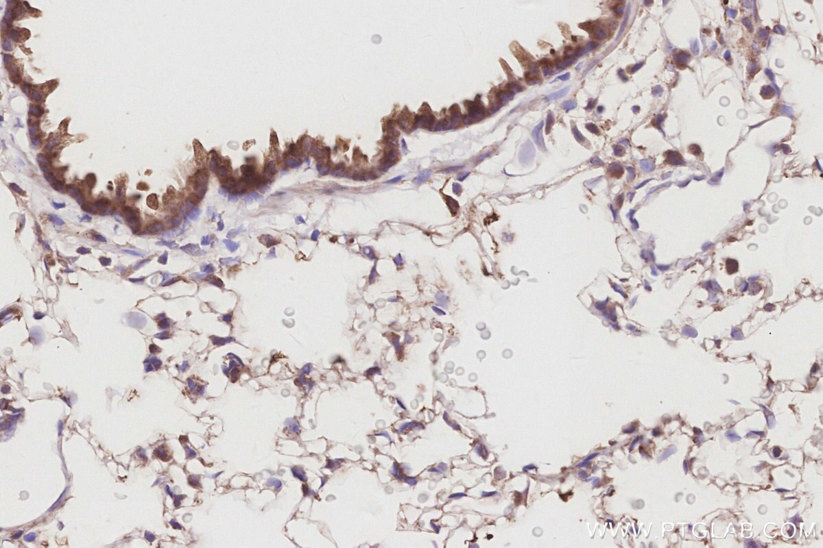 Immunohistochemistry (IHC) staining of rat lung tissue using MUDENG Polyclonal antibody (26567-1-AP)