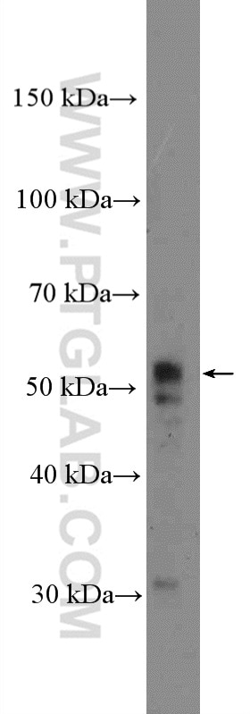 Western Blot (WB) analysis of mouse cerebellum tissue using MUDENG Polyclonal antibody (26567-1-AP)