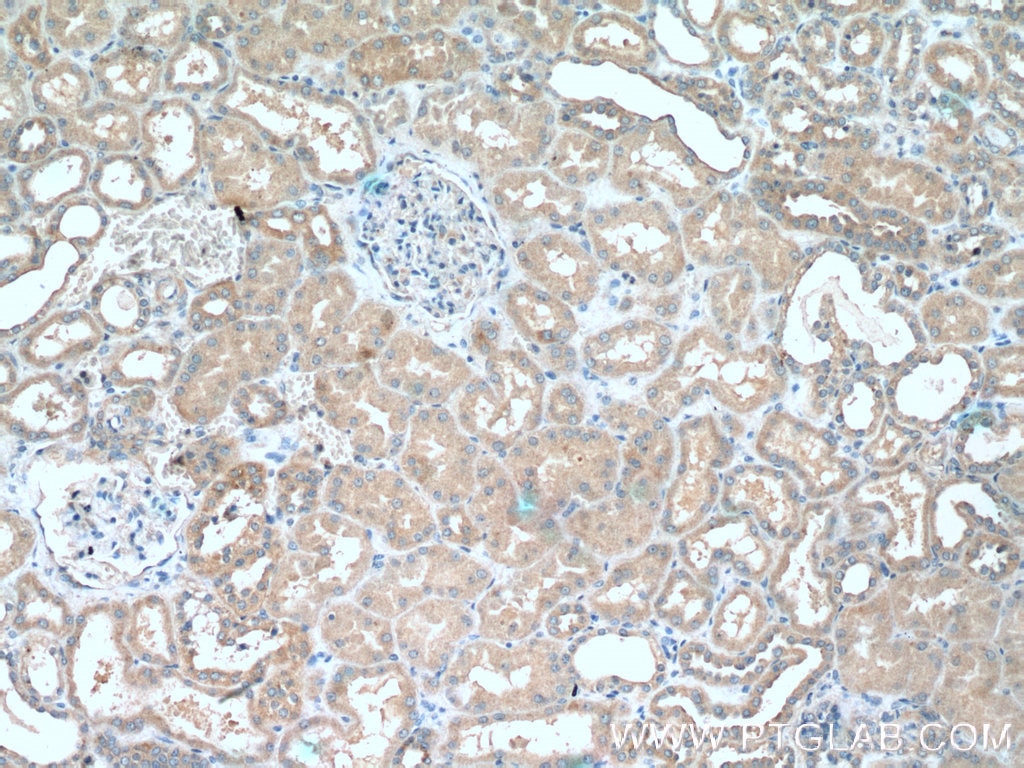 IHC staining of human kidney using 16133-1-AP Immunohistochemistry (IHC) staining of human kidney tissue using MUL1 Polyclonal antibody (16133-1-AP)