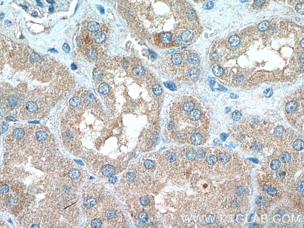 IHC staining of human kidney using 16133-1-AP Immunohistochemistry (IHC) staining of human kidney tissue using MUL1 Polyclonal antibody (16133-1-AP)