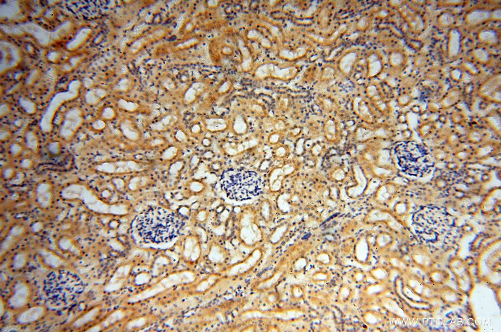 Immunohistochemistry (IHC) staining of human kidney tissue using MUL1 Polyclonal antibody (16133-1-AP)