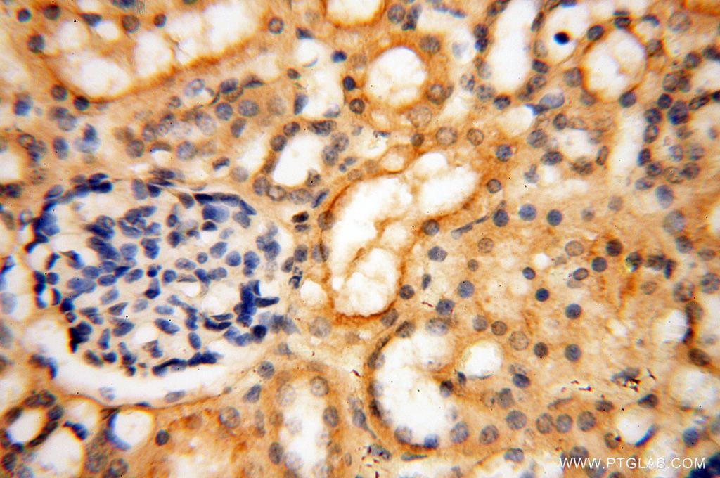 Immunohistochemistry (IHC) staining of human kidney tissue using MUL1 Polyclonal antibody (16133-1-AP)