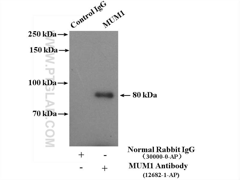Immunoprecipitation (IP) experiment of Jurkat cells using MUM1 Polyclonal antibody (12682-1-AP)