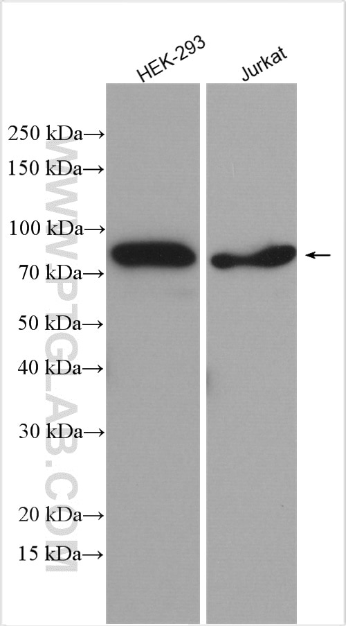 Western Blot (WB) analysis of various lysates using MUM1 Polyclonal antibody (12682-1-AP)