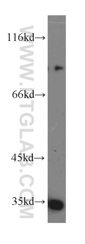 Western Blot (WB) analysis of Jurkat cells using MUM1 Polyclonal antibody (12682-1-AP)