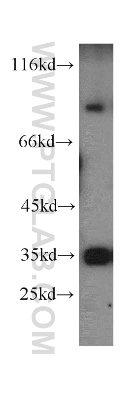 Western Blot (WB) analysis of HT-1080 cells using MUM1 Polyclonal antibody (12682-1-AP)