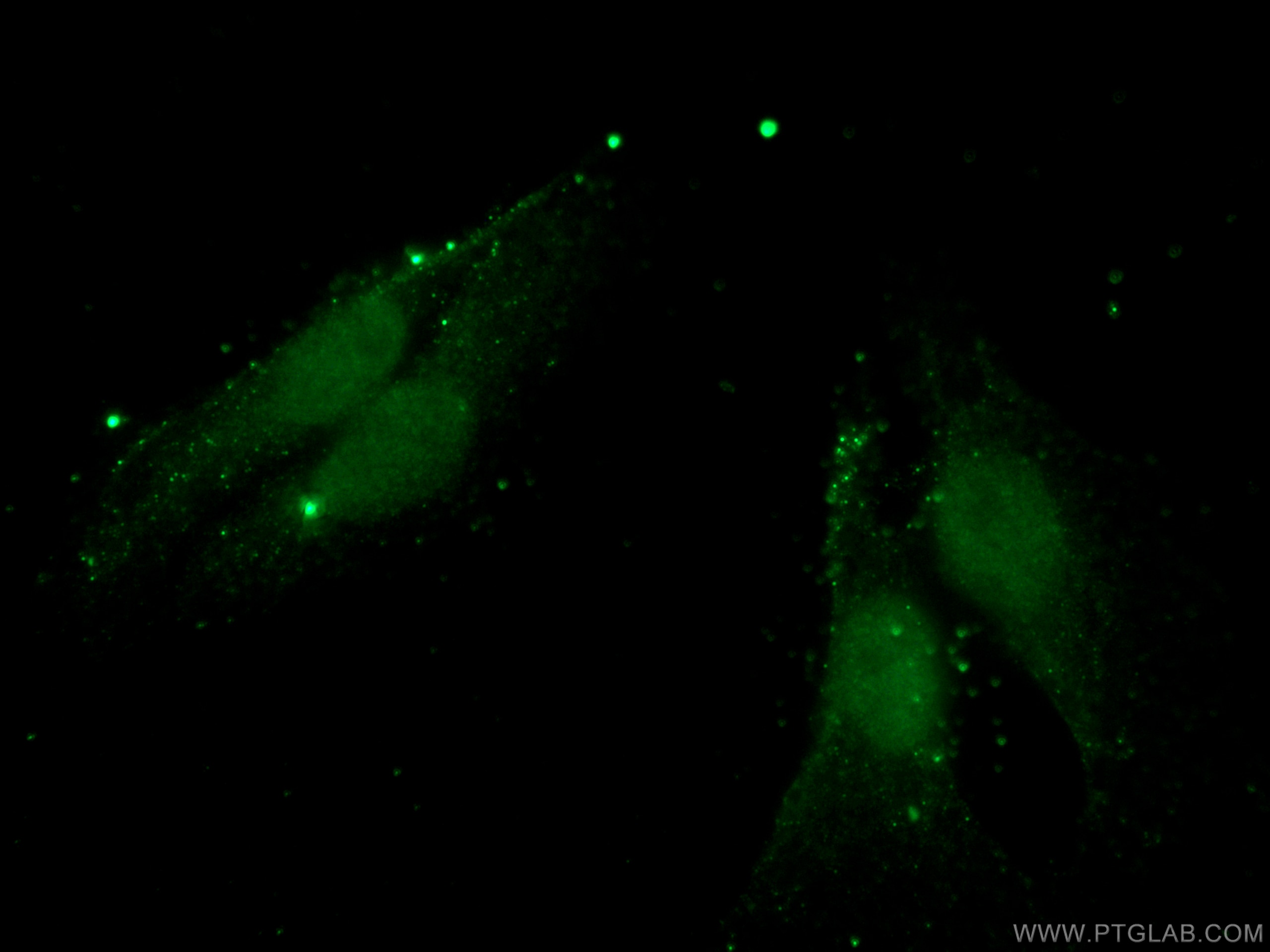 Immunofluorescence (IF) / fluorescent staining of A375 cells using MUM1 Monoclonal antibody (60353-1-Ig)