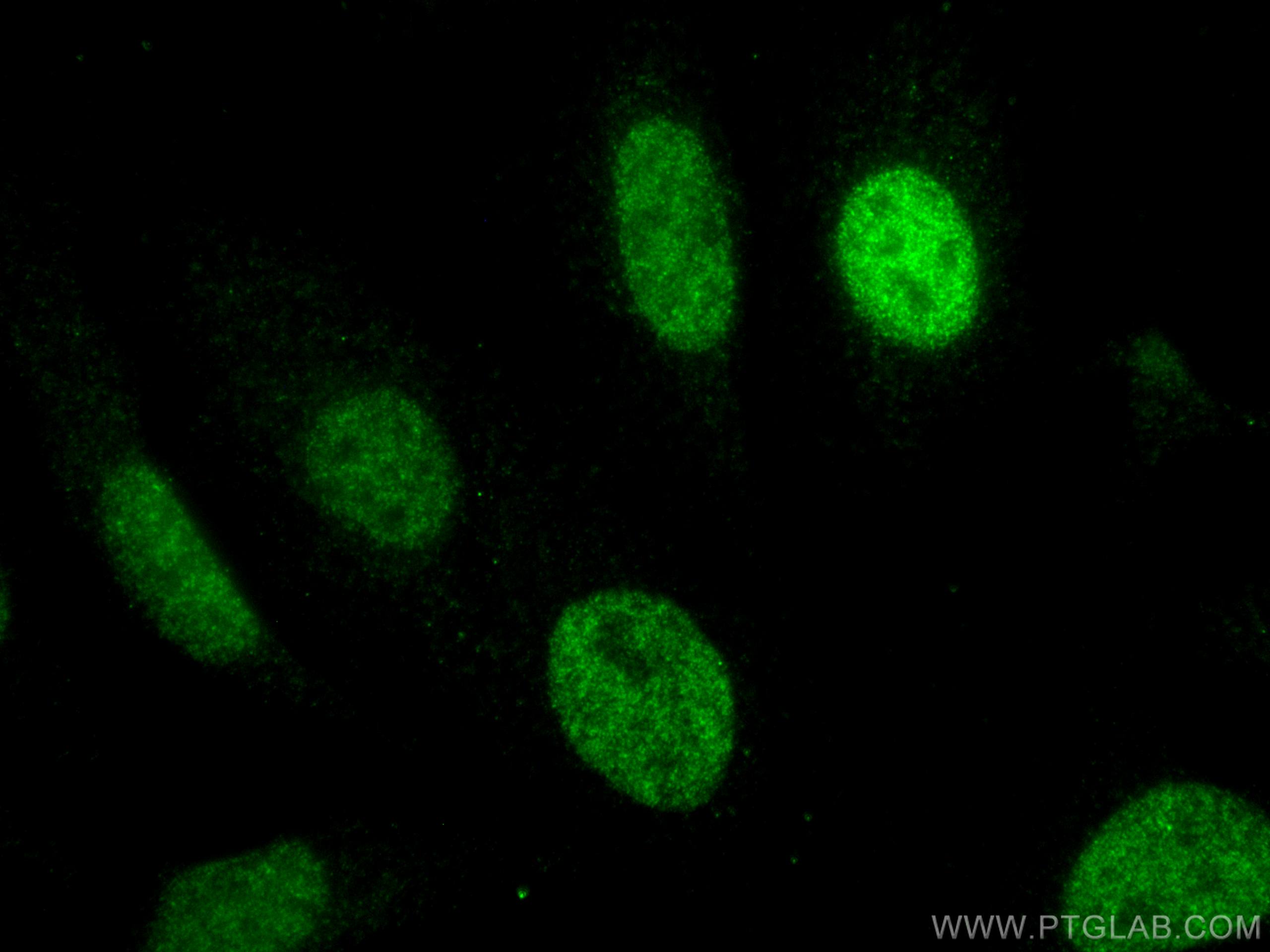 Immunofluorescence (IF) / fluorescent staining of HeLa cells using MUM1 Monoclonal antibody (60353-1-Ig)