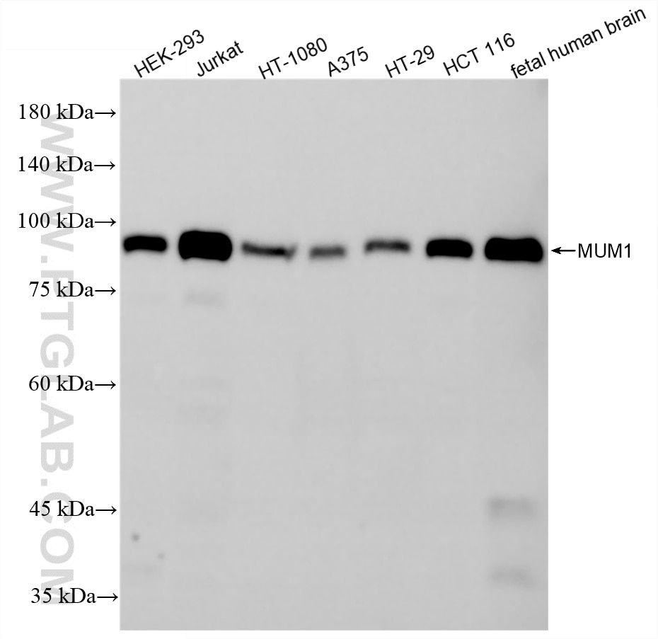 Western Blot (WB) analysis of various lysates using MUM1 Recombinant monoclonal antibody (87147-1-RR)
