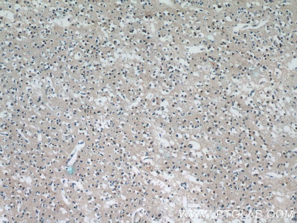 Immunohistochemistry (IHC) staining of human brain tissue using MUM1L1 Polyclonal antibody (24762-1-AP)