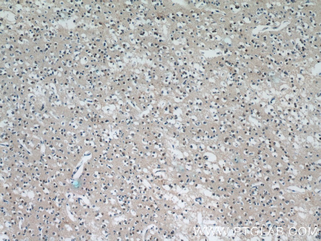 IHC staining of human brain using 24762-1-AP