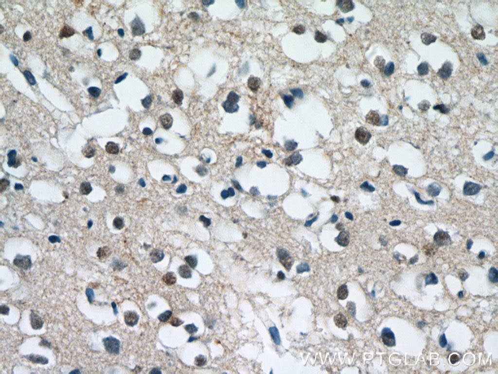 Immunohistochemistry (IHC) staining of human brain tissue using MUM1L1 Polyclonal antibody (24762-1-AP)