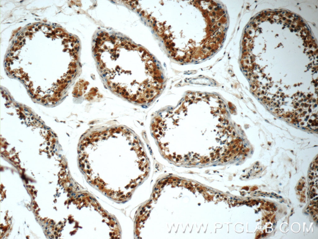 Immunohistochemistry (IHC) staining of human testis tissue using MUM1L1 Polyclonal antibody (24762-1-AP)