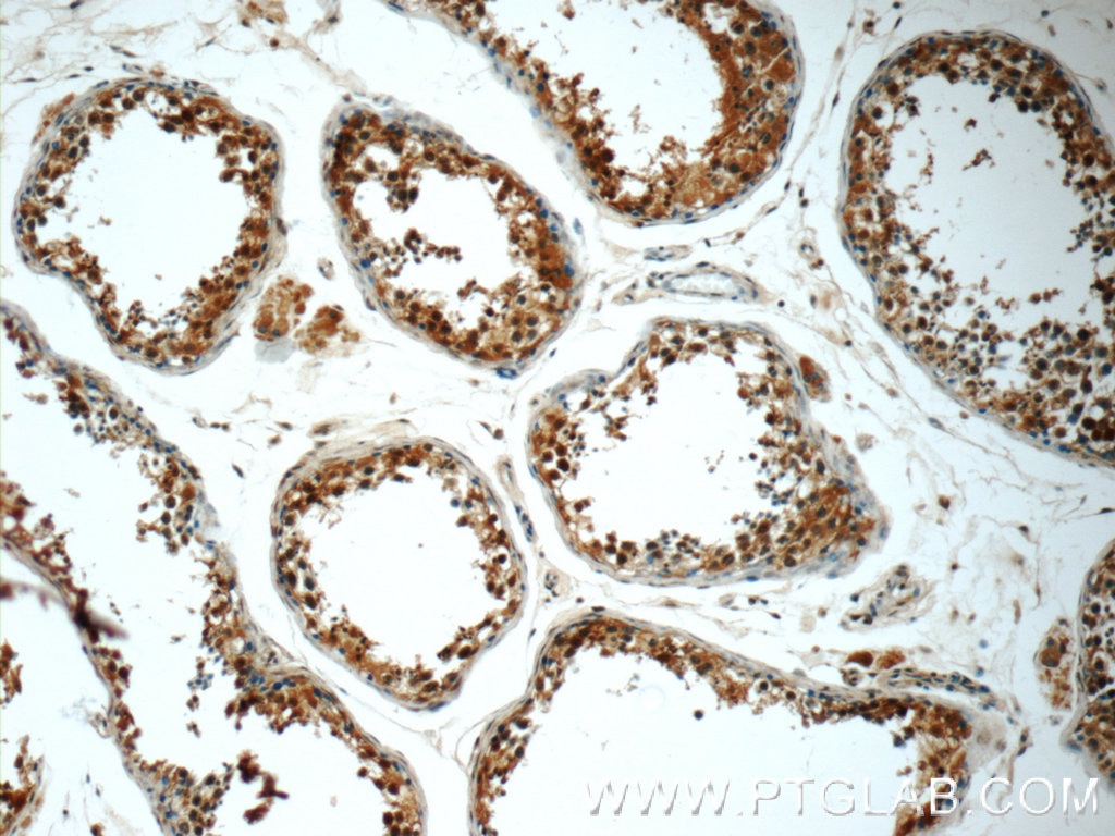 IHC staining of human testis using 24762-1-AP