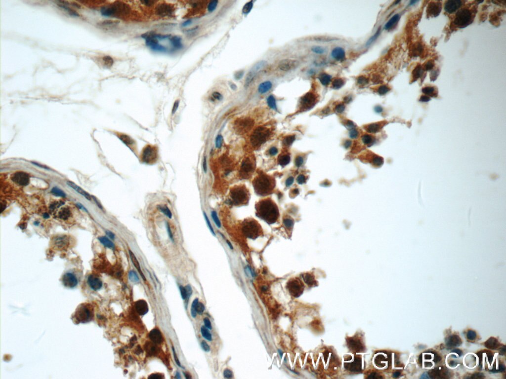 Immunohistochemistry (IHC) staining of human testis tissue using MUM1L1 Polyclonal antibody (24762-1-AP)