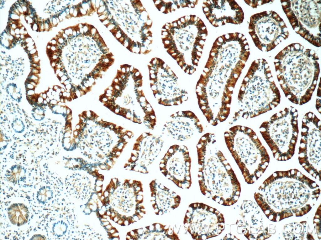 Immunohistochemistry (IHC) staining of human small intestine tissue using MUPCDH Polyclonal antibody (25619-1-AP)