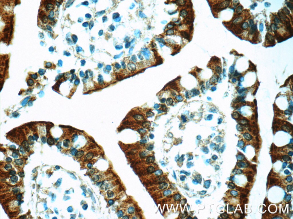 IHC staining of human small intestine using 25619-1-AP