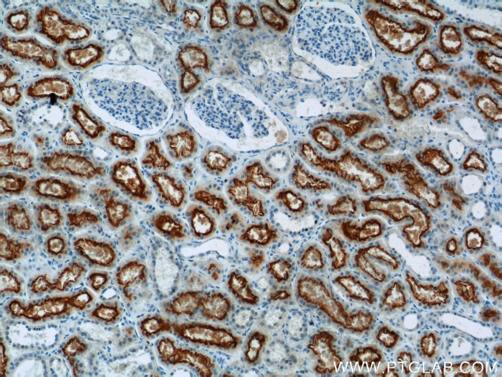 Immunohistochemistry (IHC) staining of human kidney tissue using MUPCDH Polyclonal antibody (25619-1-AP)