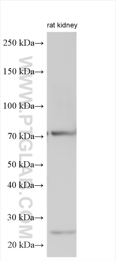 Western Blot (WB) analysis of various lysates using CDHR5 Polyclonal antibody (25619-1-AP)