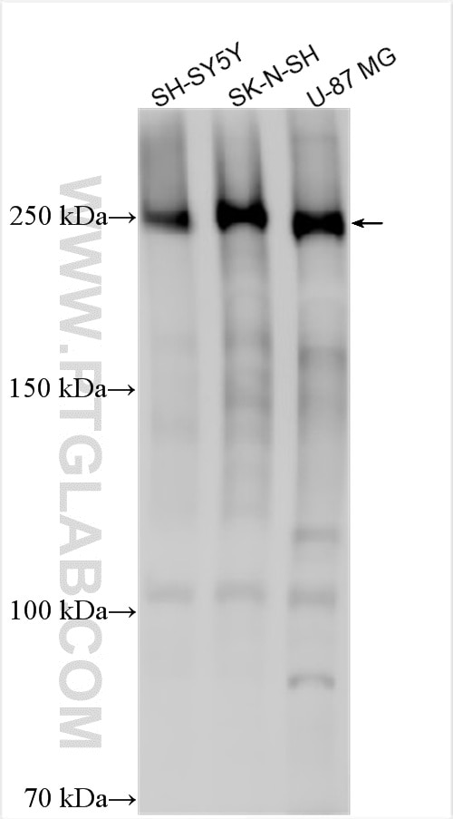 Various lysates were subjected to SDS PAGE followed by western blot with 22583-1-AP (MUPP1 antibody) at dilution of 1:1000 incubated at room temperature for 1.5 hours. Western Blot (WB) analysis of various lysates using MUPP1 Polyclonal antibody (22583-1-AP)