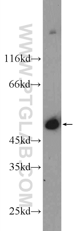 Western Blot (WB) analysis of mouse heart tissue using MURC Polyclonal antibody (55464-1-AP)
