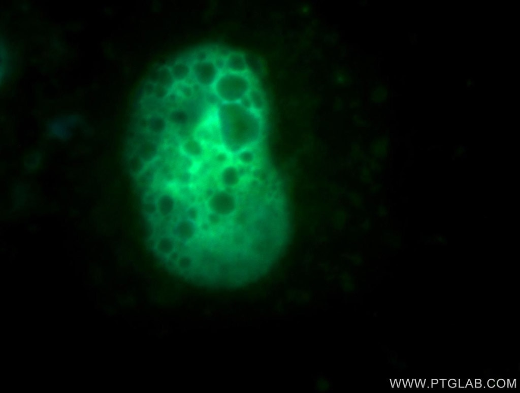 IF Staining of MCF-7 using 11018-1-AP