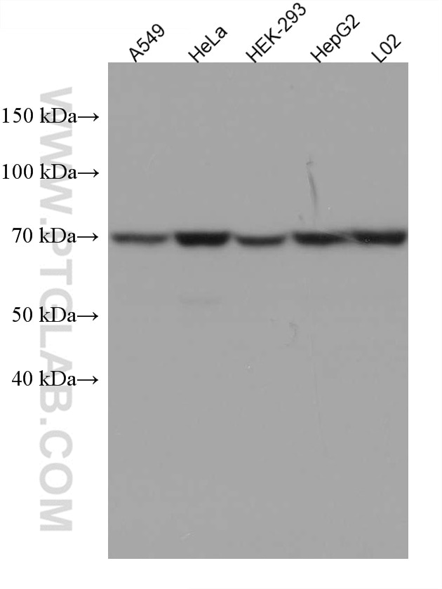 Western Blot (WB) analysis of various lysates using MUS81 Monoclonal antibody (67351-1-Ig)