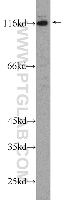 Western Blot (WB) analysis of Jurkat cells using MUSK Polyclonal antibody (22112-1-AP)