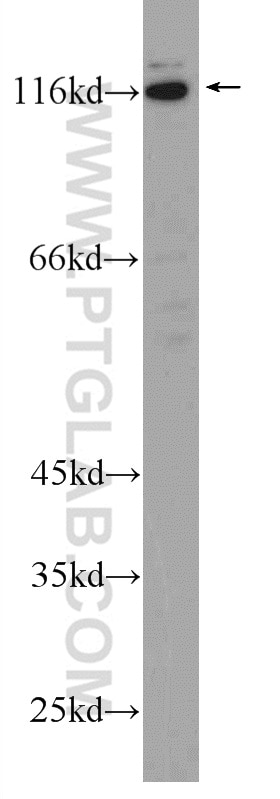 Western Blot (WB) analysis of Jurkat cells using MUSK Polyclonal antibody (22112-1-AP)