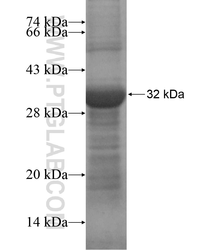 MUSK fusion protein Ag17371 SDS-PAGE