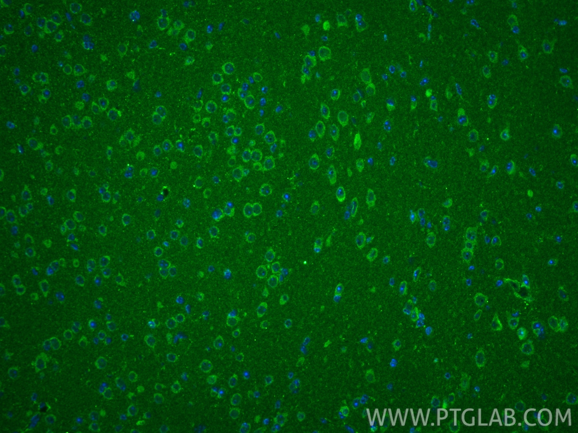 Immunofluorescence (IF) / fluorescent staining of mouse brain tissue using Methylmalonyl Coenzyme A mutase/MUT Polyclonal ant (17034-1-AP)