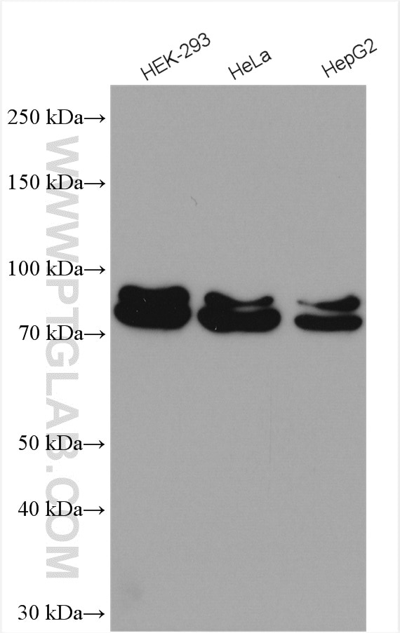 Western Blot (WB) analysis of various lysates using MUT Polyclonal antibody (17034-1-AP)