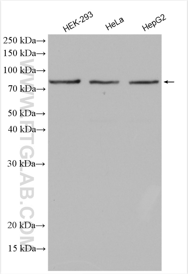 Western Blot (WB) analysis of various lysates using Methylmalonyl Coenzyme A mutase/MUT Polyclonal ant (17034-1-AP)