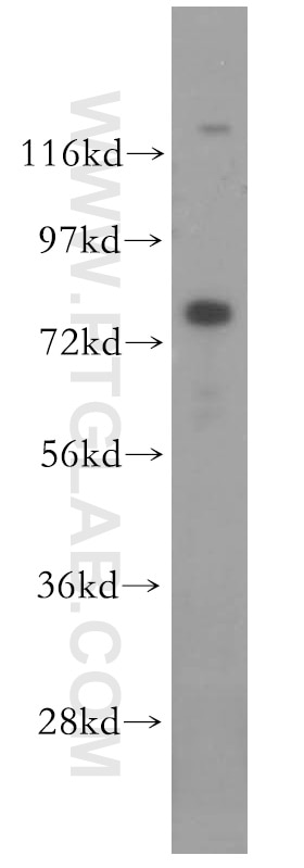 Western Blot (WB) analysis of HepG2 cells using MUT Polyclonal antibody (17034-1-AP)