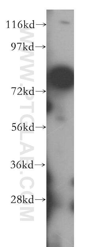 Western Blot (WB) analysis of HeLa cells using MUT Polyclonal antibody (17034-1-AP)