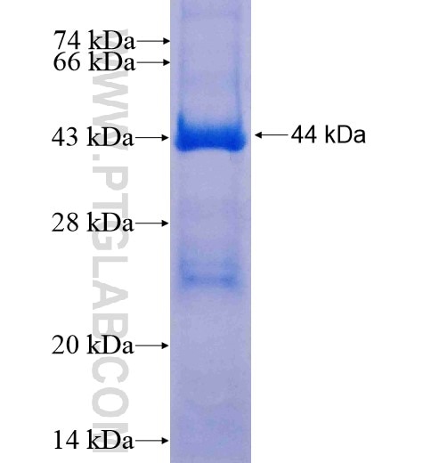 MUT fusion protein Ag10502 SDS-PAGE