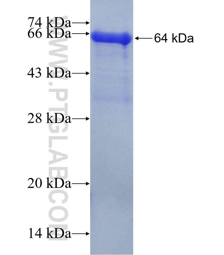 MUT fusion protein Ag10523 SDS-PAGE