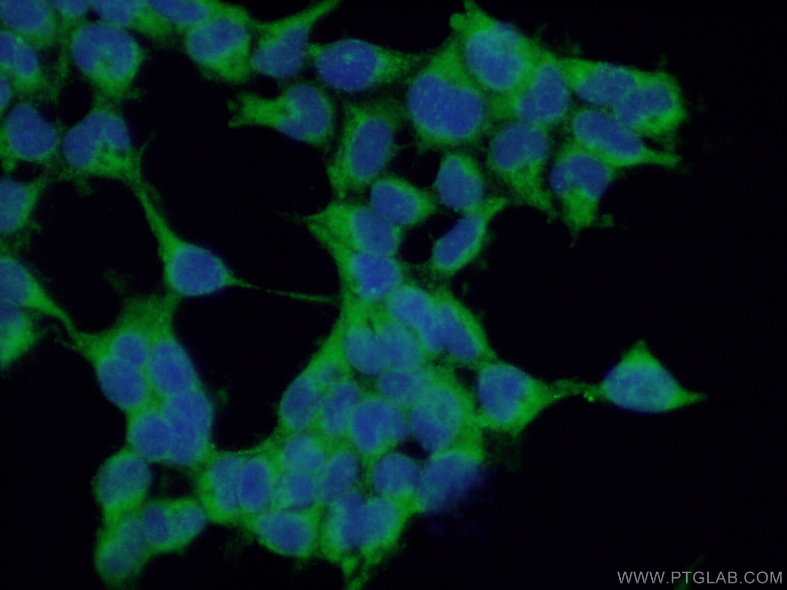 Immunofluorescence (IF) / fluorescent staining of HEK-293 cells using MUTED/BLOC1S5 Polyclonal antibody (24015-1-AP)