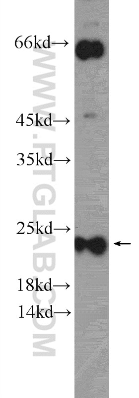 Western Blot (WB) analysis of HEK-293T cells using MUTED/BLOC1S5 Polyclonal antibody (24015-1-AP)