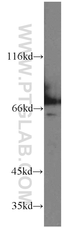 Western Blot (WB) analysis of HeLa cells using MUTYH Polyclonal antibody (15237-1-AP)