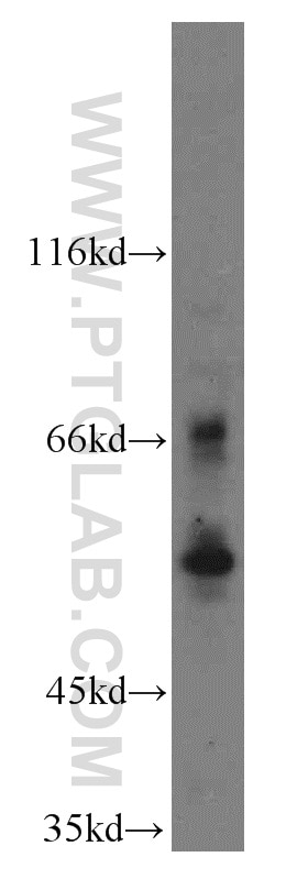 Western Blot (WB) analysis of Raji cells using MUTYH Polyclonal antibody (15237-1-AP)