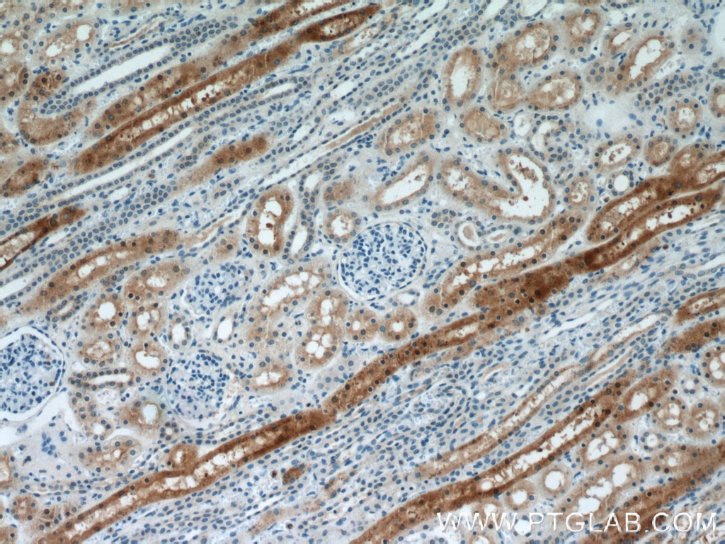 Immunohistochemistry (IHC) staining of human kidney tissue using MUTYH Polyclonal antibody (19650-1-AP)