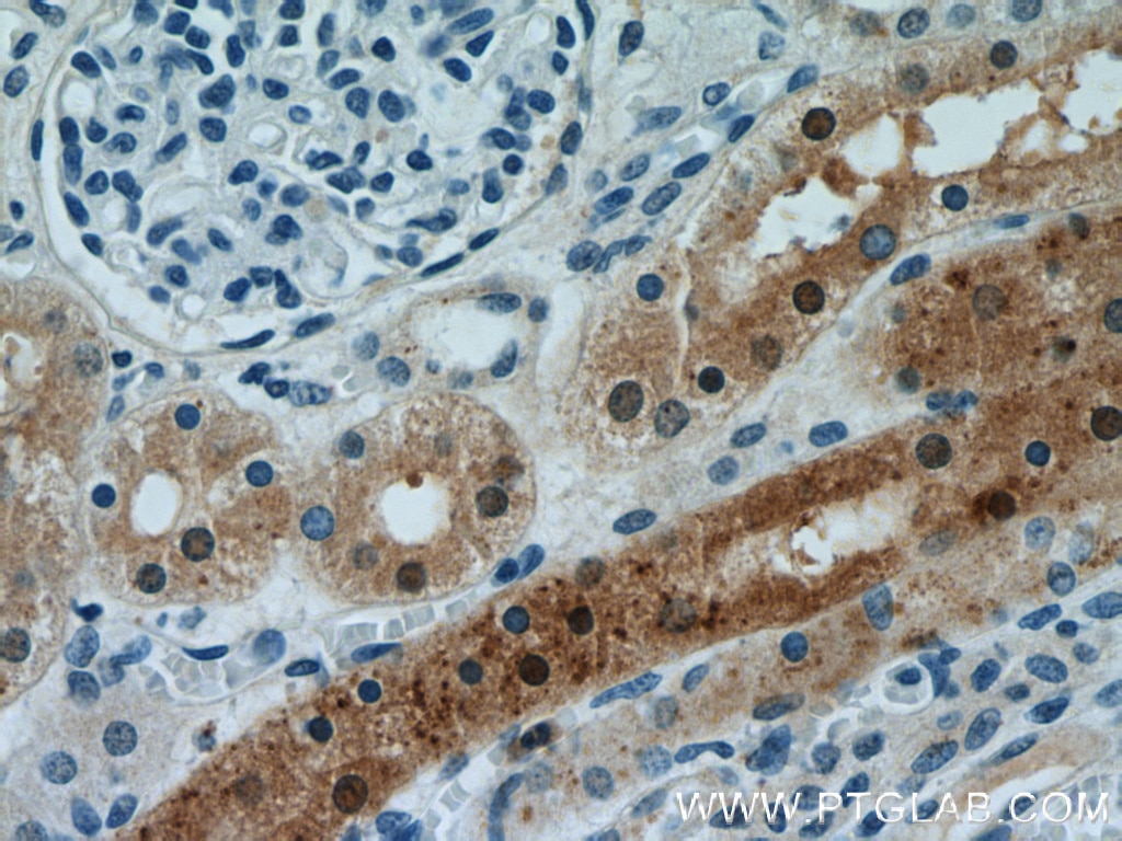 Immunohistochemistry (IHC) staining of human kidney tissue using MUTYH Polyclonal antibody (19650-1-AP)
