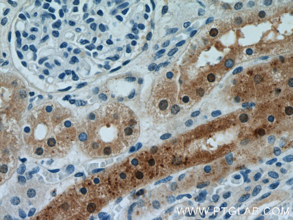 IHC staining of human kidney using 19650-1-AP