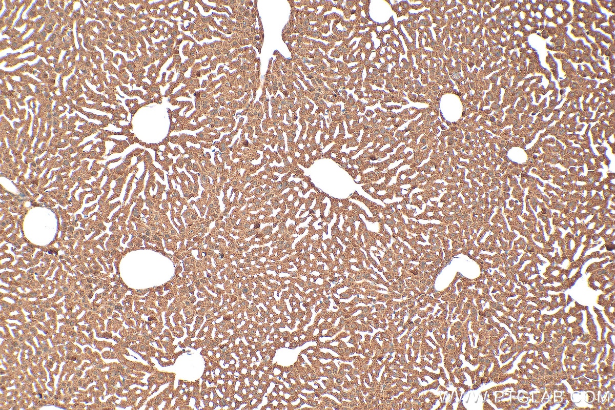 Immunohistochemistry (IHC) staining of mouse liver tissue using MUTYH Polyclonal antibody (19650-1-AP)