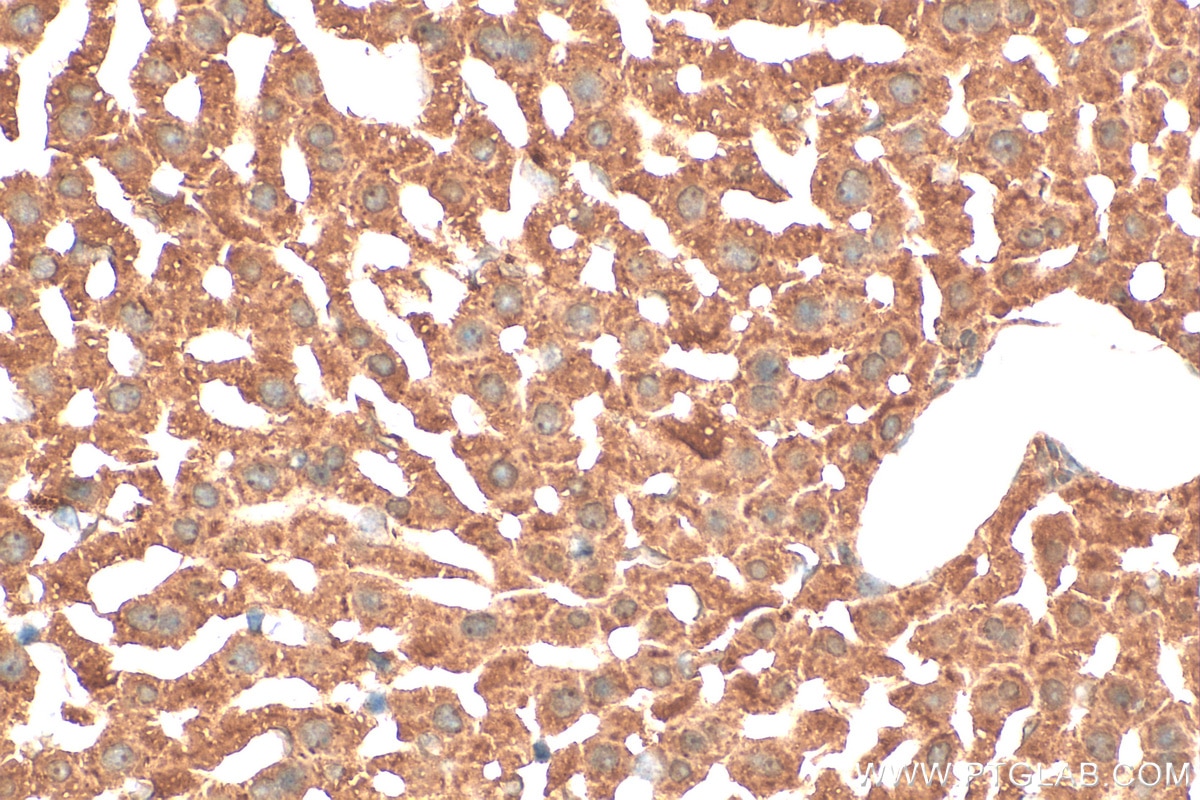 Immunohistochemistry (IHC) staining of mouse liver tissue using MUTYH Polyclonal antibody (19650-1-AP)