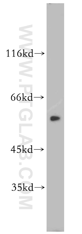 Western Blot (WB) analysis of HeLa cells using MUTYH Polyclonal antibody (19650-1-AP)
