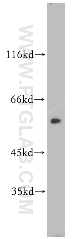 WB analysis of HeLa using 19650-1-AP