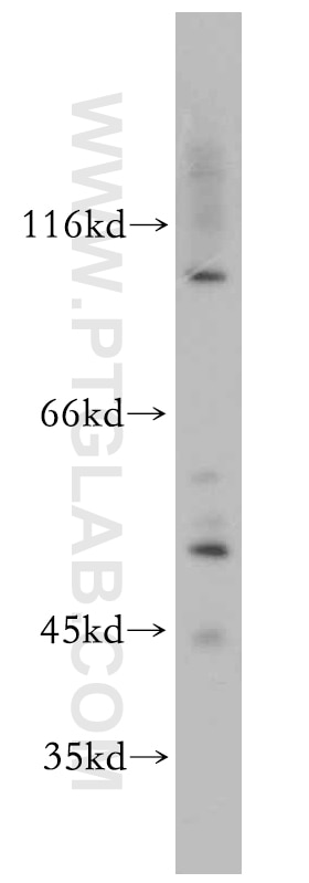 Western Blot (WB) analysis of Jurkat cells using MUTYH Polyclonal antibody (19650-1-AP)