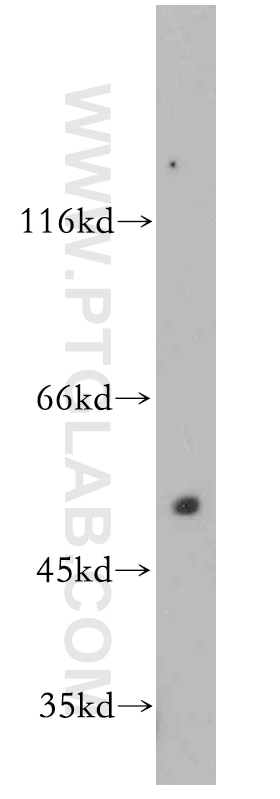 Western Blot (WB) analysis of mouse thymus tissue using MUTYH Polyclonal antibody (19650-1-AP)